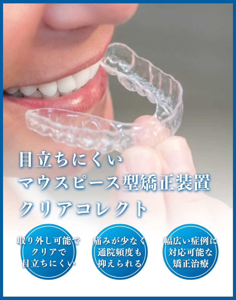 クリアコレクト矯正